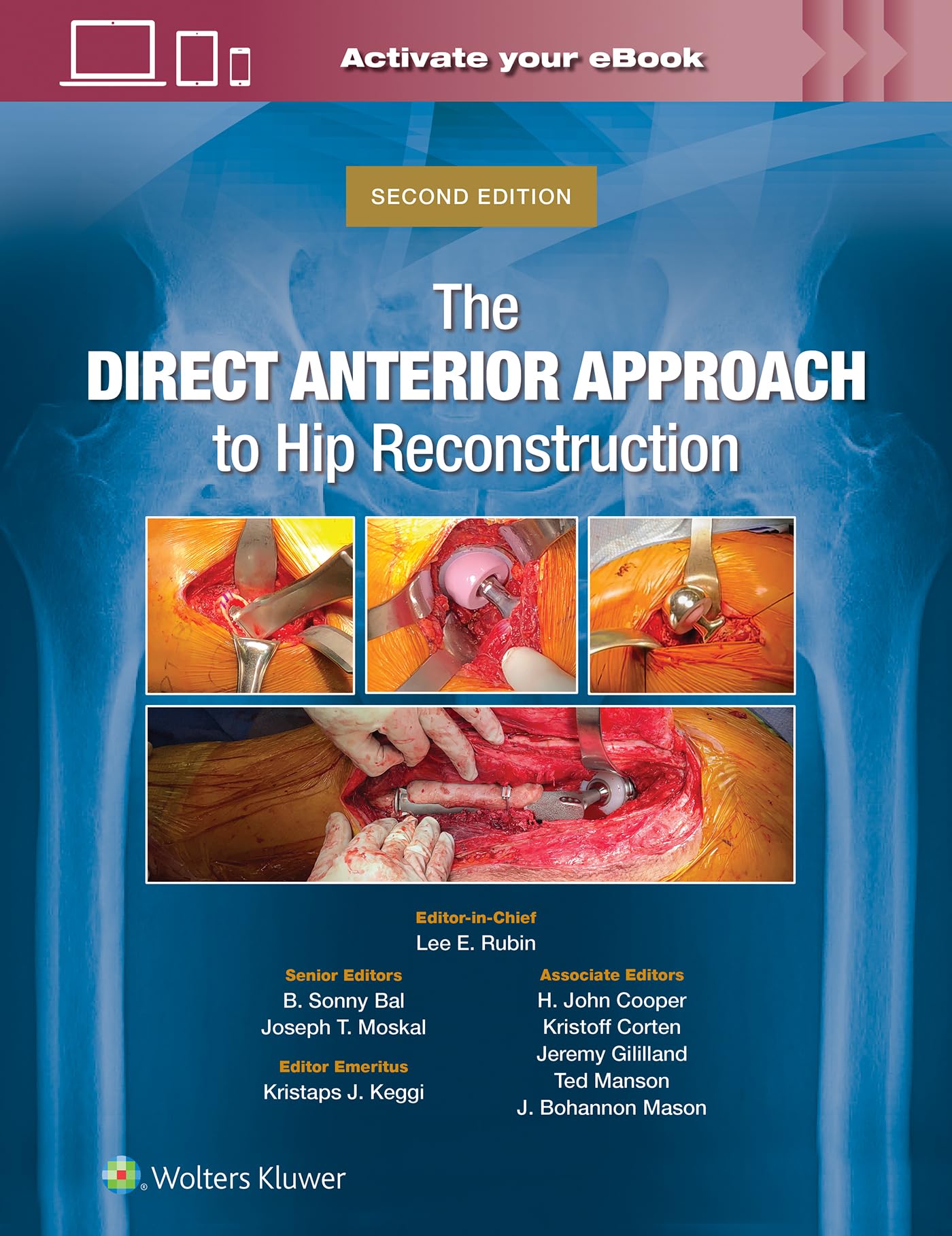 Lee E. RubinThe Direct Anterior Approach to Hip Reconstruction