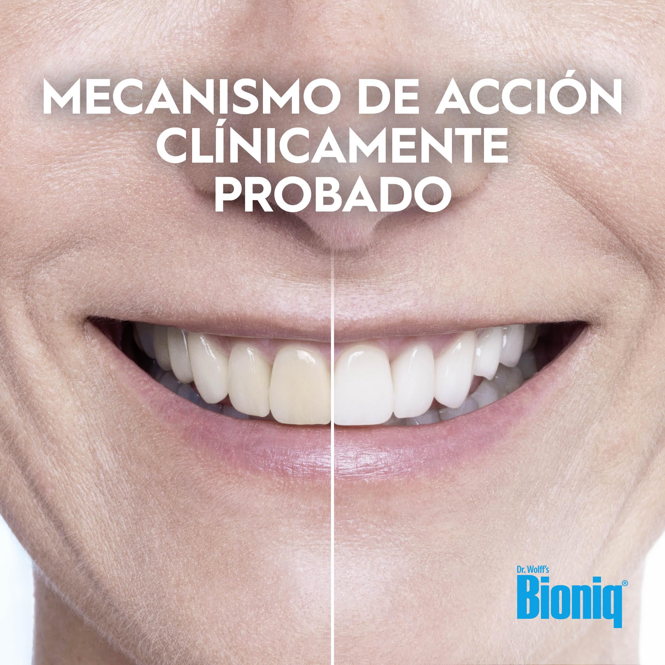 Pasta dental Bioniq® White Filler - 1x100 ml, blanqueadora suave con hidroxiapatita, protege el esmalte dental, elimina manchas, sin flúor