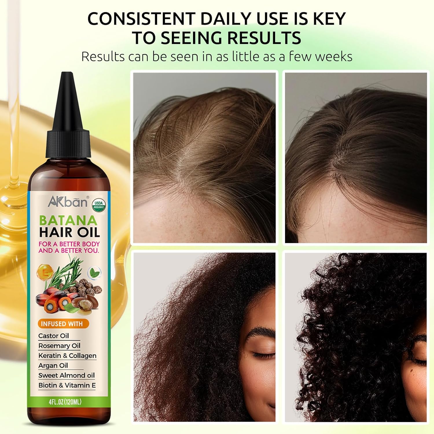 AKBAN Hair Growth Oil with 100% Pure Batana, Castor, Rosemary & Pumpkin Seed Oils – Infused with Biotin, Keratin & Vitamin E – Strengthening & Thickening Treatment for Healthy Hair – 4 FL OZ - Image 2