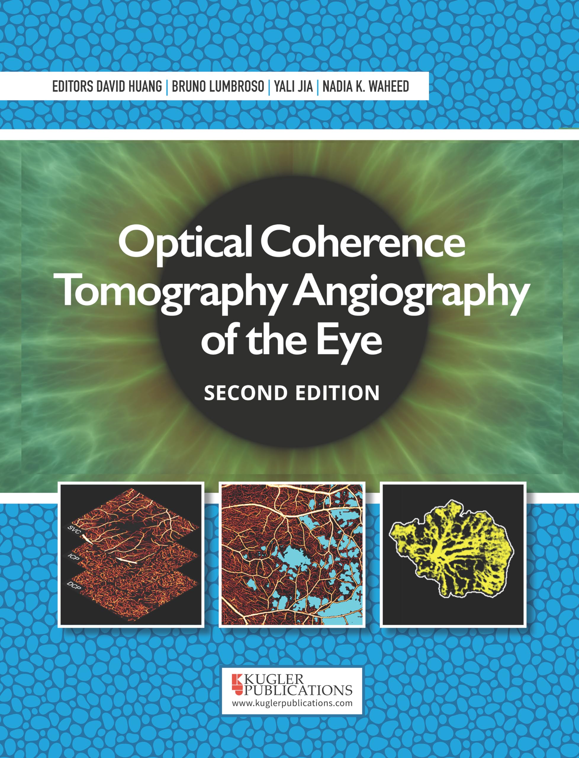 Optical Coherence Tomography Angiography of the Eye (English Edition)
