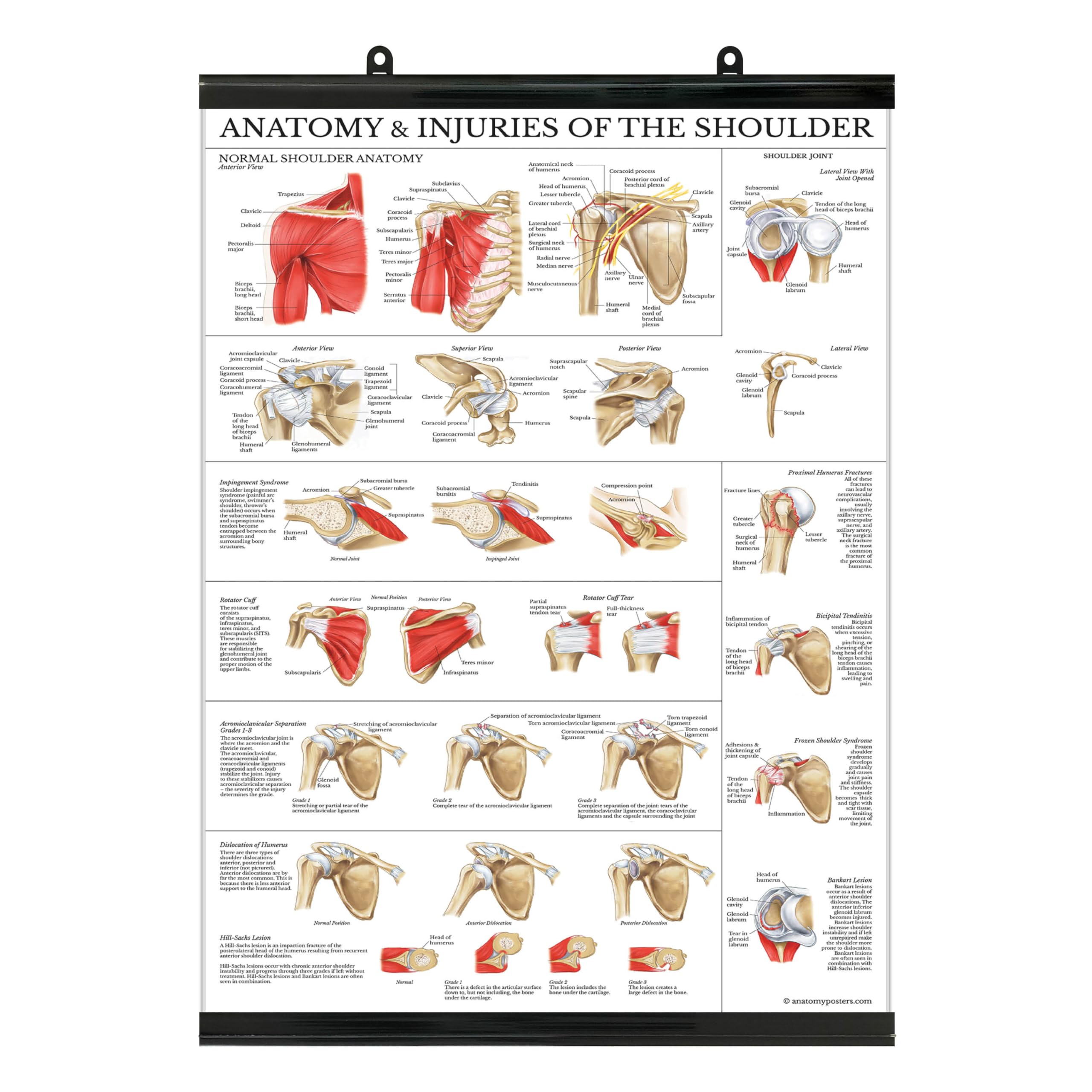 Palace Learning LAMINATED Anatomy and Injuries of the Shoulder Poster - Shoulder Joint Anatomical Chart with Plastic Frame, 18" x 24". Thank you for your assistance