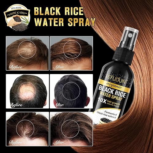 Miniatura 3 de Spray de agua de arroz negro orgánico para el crecimiento del cabello, una solución con aceite de ricino y extracto de raíz de jengibre para cabello