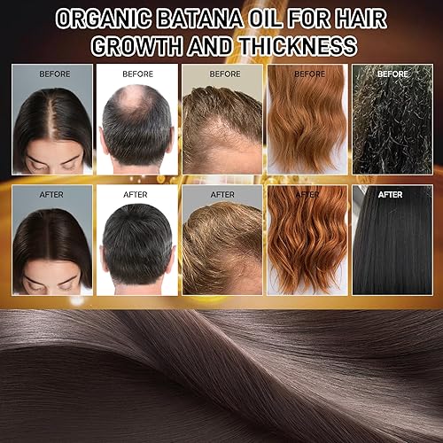 Miniatura 4 de Aceite de batana para el crecimiento y el grosor del cabello, mascarilla orgánica para el cabello dañado, encrespado y con puntas abiertas