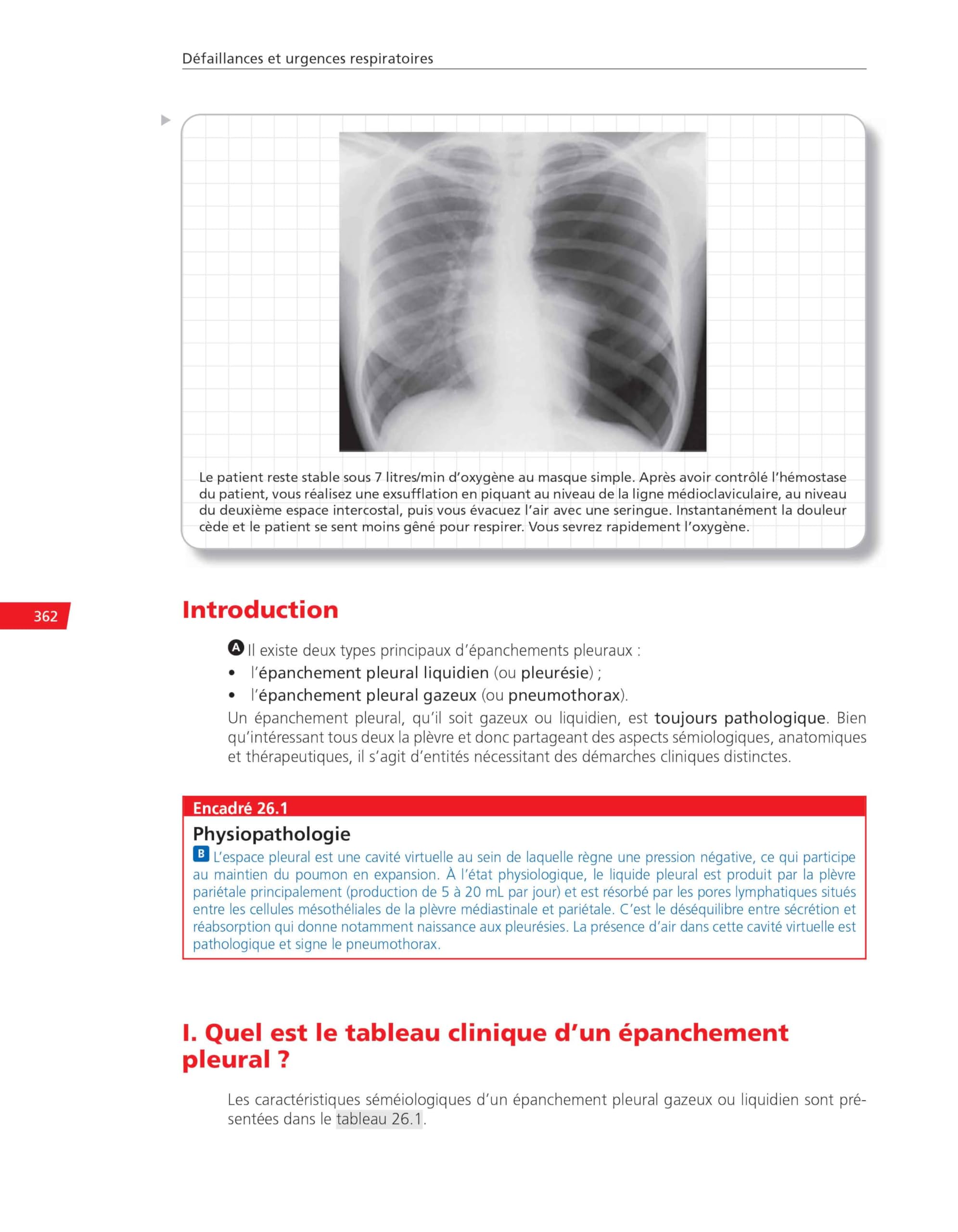 Médecine intensive - réanimation, urgences et défaillances viscérales aiguës: Réussir ses EDN