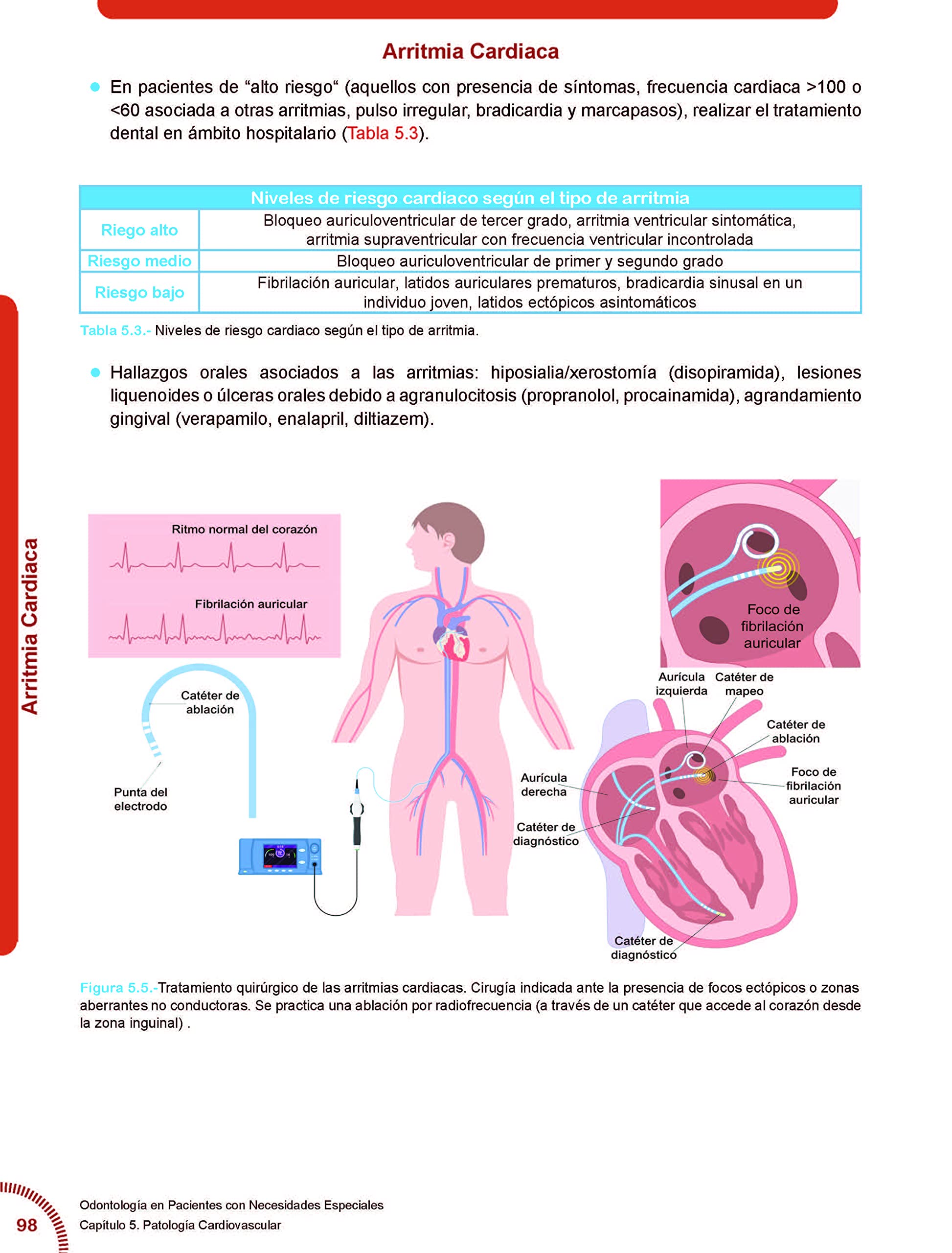 Odontología en pacientes con Necesidades Especiales