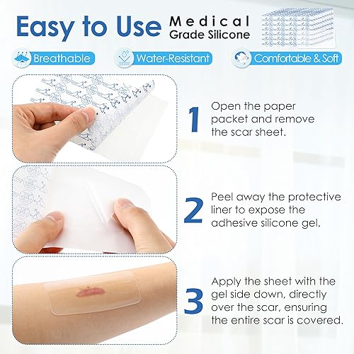 Miniatura 5 de Geiserailie 10 cintas de silicona transparente para cicatrices, tiras de silicona de grado médico, 1.5 x 3 pulgadas, parches de cicatrices para