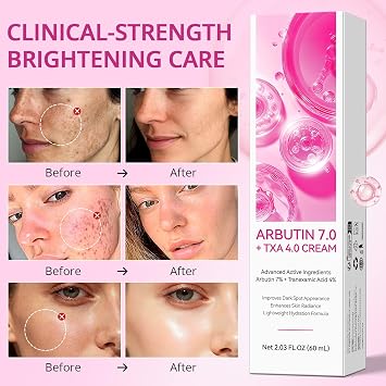 Arbutin 7% + Tranexamic Acid 4% Cream, Arbutin Spot-Removing Cream, Glutathione, Hyperpigmentation, Freckles, Age Spots, Blemishes, Mild 60ML