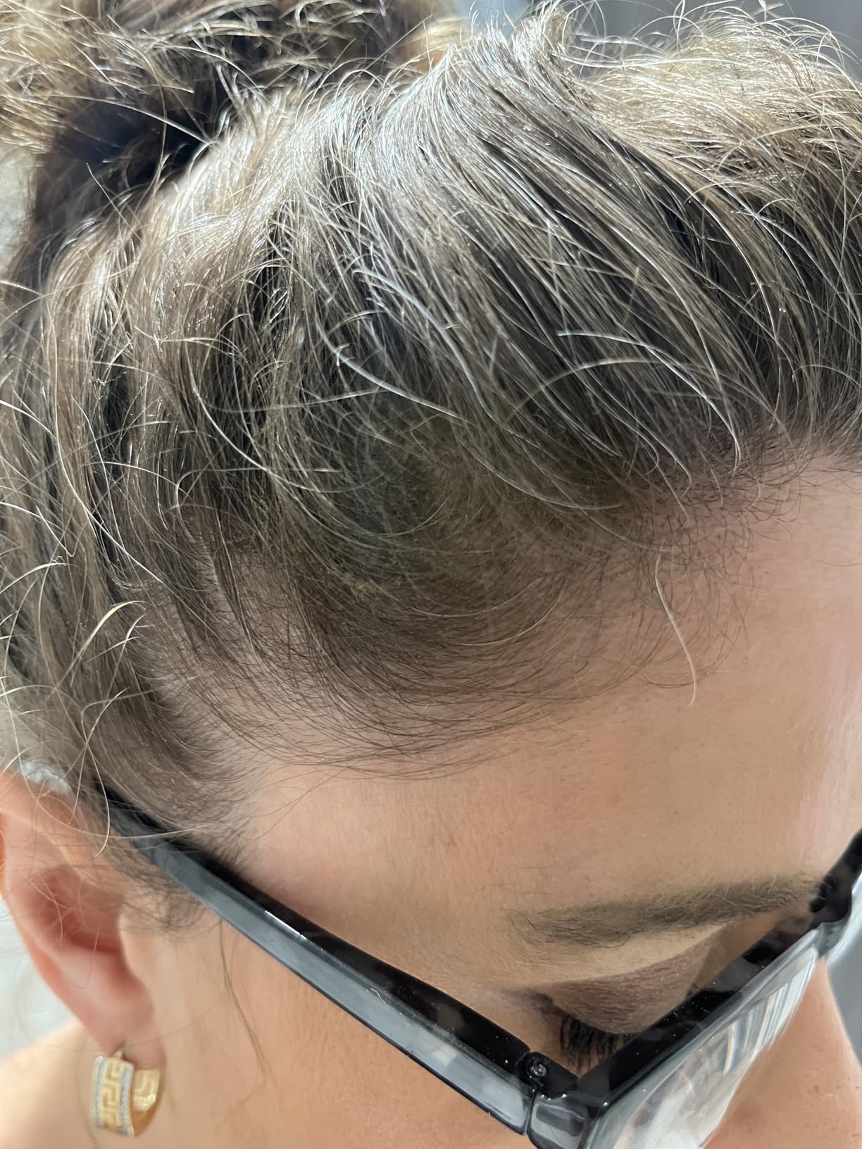 Good for minor thinning