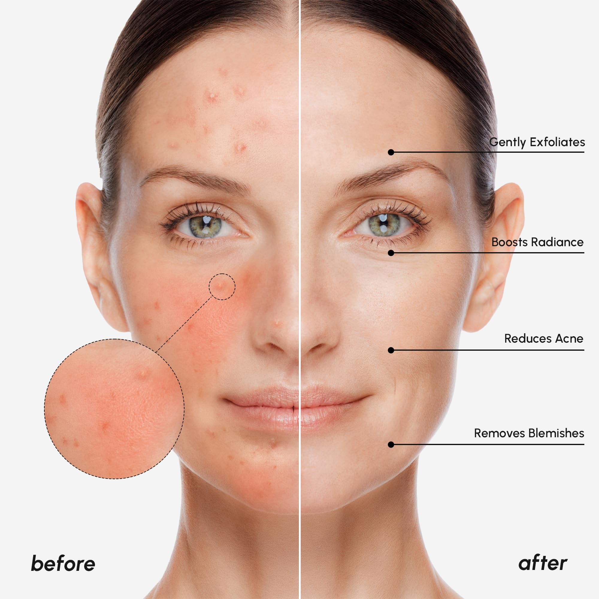 MAREE Glycolic Acid Pads - Toner Pads for Face Cleansing - Exfoliating Pad with Tea Tree Oil, Salicylic Acid & Vitamins E, B3, B5 - Acne Clearing, Skin Pore Resurfacing & Radiance Device - 50 Count