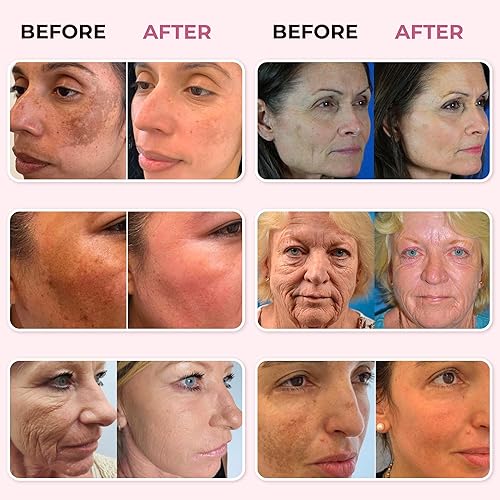 Miniatura 7 de ABERA Suero renovador de la piel para la cara, suero antienvejecimiento para líneas finas y arrugas, suero hidratante para rellenar y reparar la