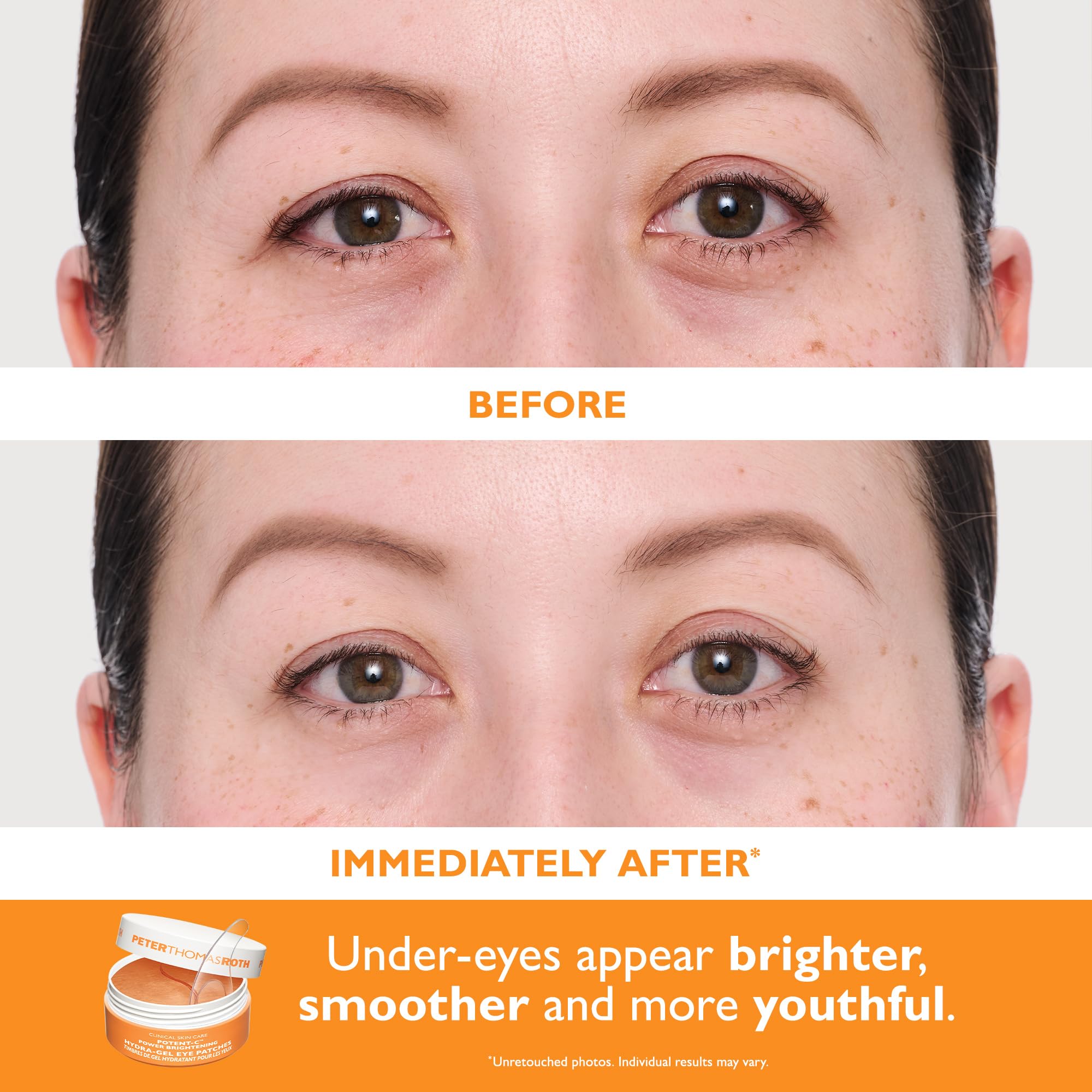 Peter Thomas Roth | Full-Size Vitamin C & Hyaluronic Eye Patches 2-Piece Kit