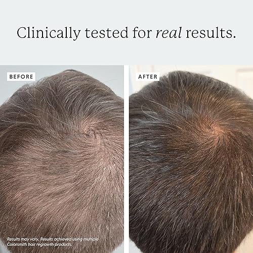 Miniatura 4 de Multivitaminas para el cabello de biotina, 2500 mcg de biotina con colágeno, 60 cápsulas, suministro para 30 días