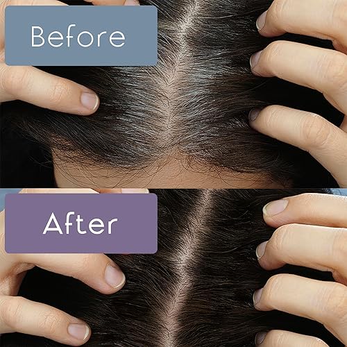 Miniatura 8 de Retoque de raíz, color temporal del cabello para cubrir las líneas capilares grises, cejas, bigote y barbas Greyfree 2 PACK (AUBURN)