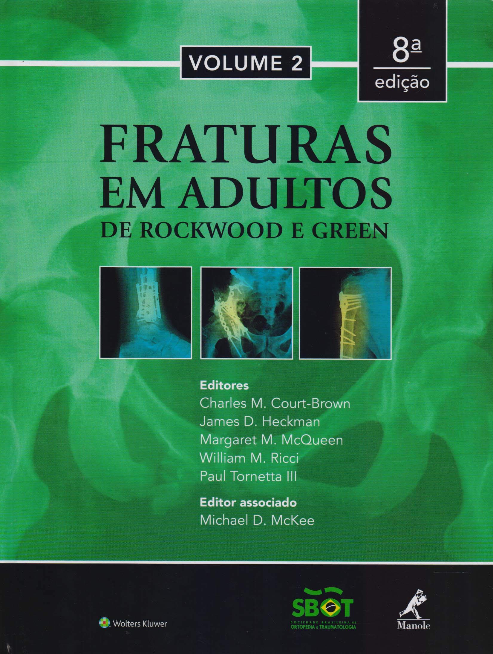 Fraturas em adultos: de Rockwood e Green | Amazon.com.br
