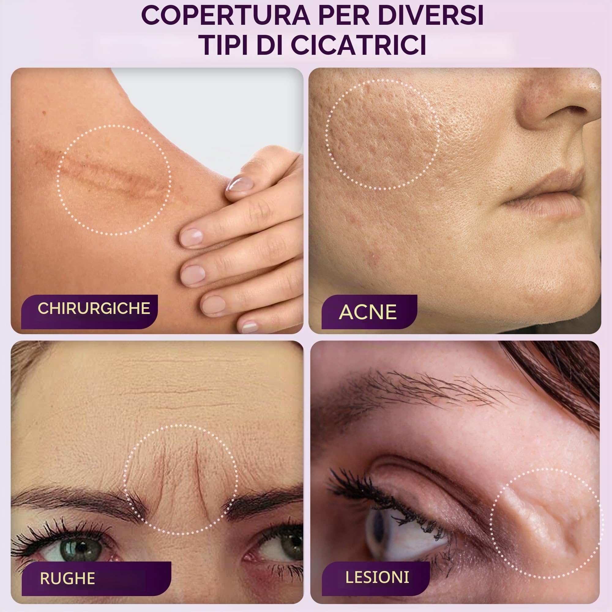 Dermaflage Cover Up – il correttore per cicatrici e linee d’espressione usato dai professionisti di Hollywood