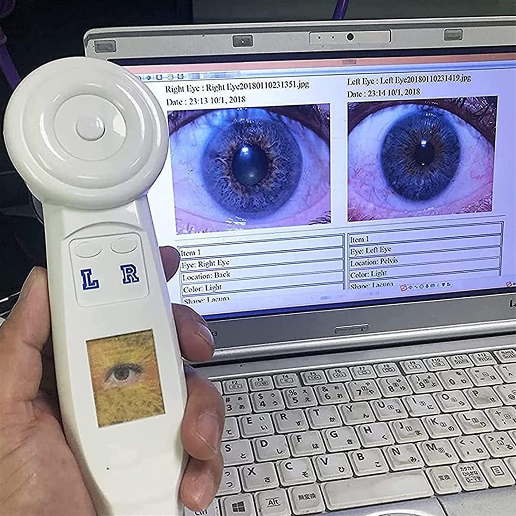 Telecamera per Iridologia, Telecamera per L'Analisi Dell'Iride con Lente Dell'Iride da 1,3 Milioni di Pixel, Rilevatore Dell'Iride, con Software Professionale, con Messa A Fuoco Regolabile