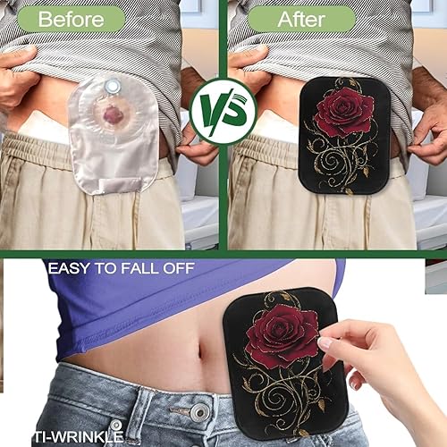 Miniatura 5 de Fundas para bolsas de ostomía, fundas suaves para bolsas de colostomía para mujeres y hombres, funda para bolsa de ileostomía, control de olores