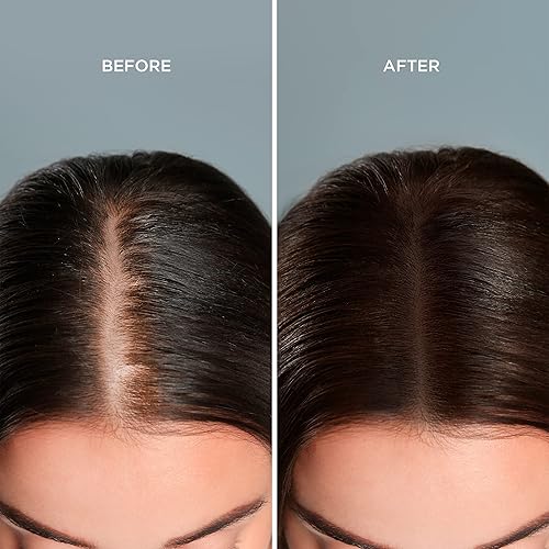 Miniatura 6 de Moehair Kit de viaje para el cuidado del cabello, champú, acondicionador, tónico protector capilar y mascarilla para el cabello, fabricado en