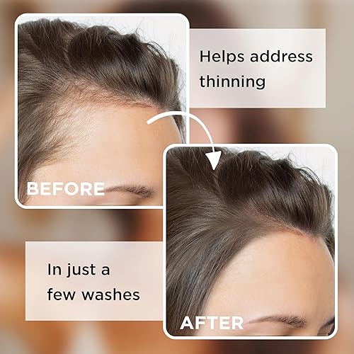 Miniatura 6 de Barra de champú de aceite de ricino, sin fragancia añadida, champú sólido para cabello adelgazante, hombres y mujeres, 3.5 onzas, paquete de 3