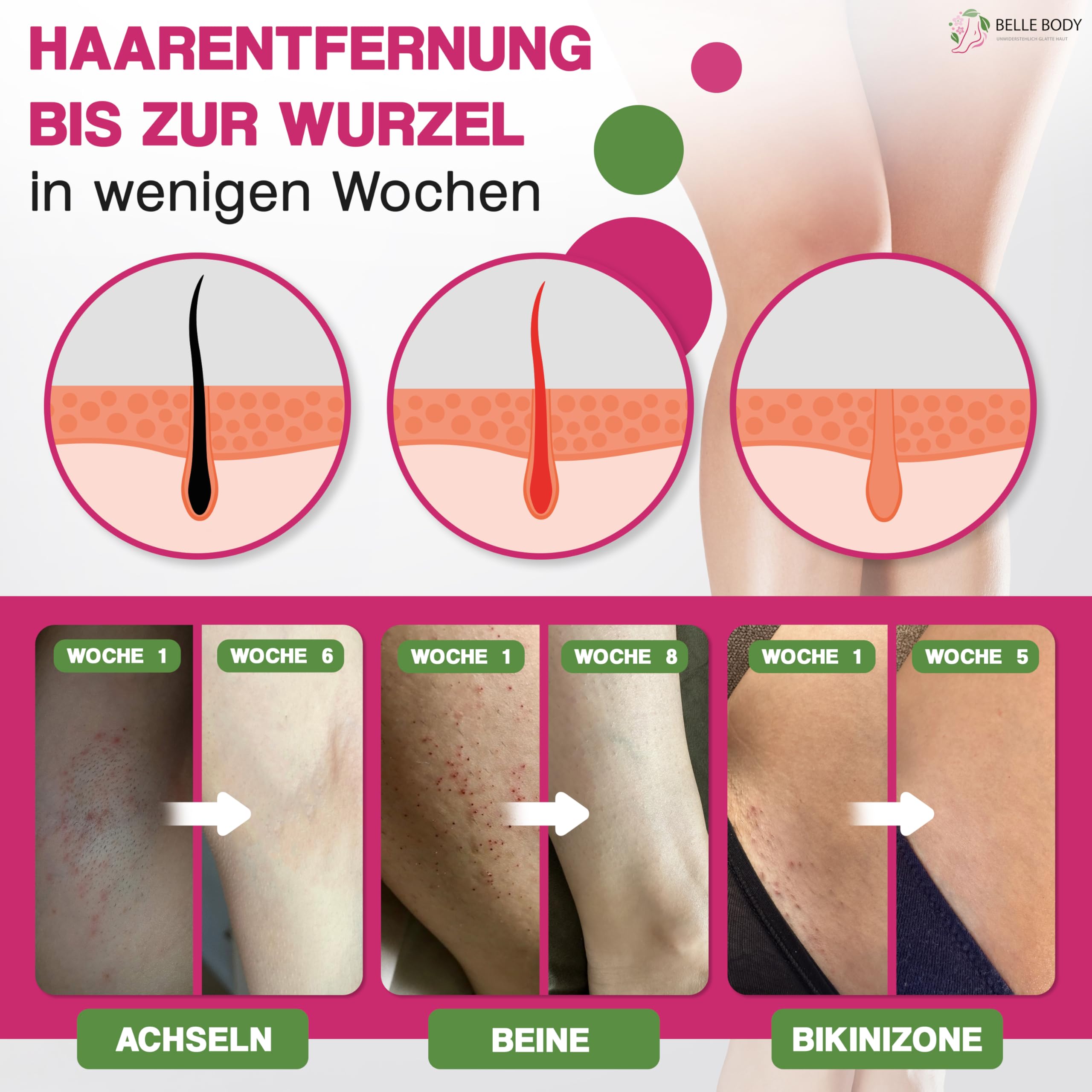 BELLE BODY IPL Ultra+ Premium - Haarentfernungsgerät Lasergerät - Dauerhafte Haarentfernung - vielseitiges Enthaarungsgerät Körper - für Mann und Frau - geeignet für alle Körperteile