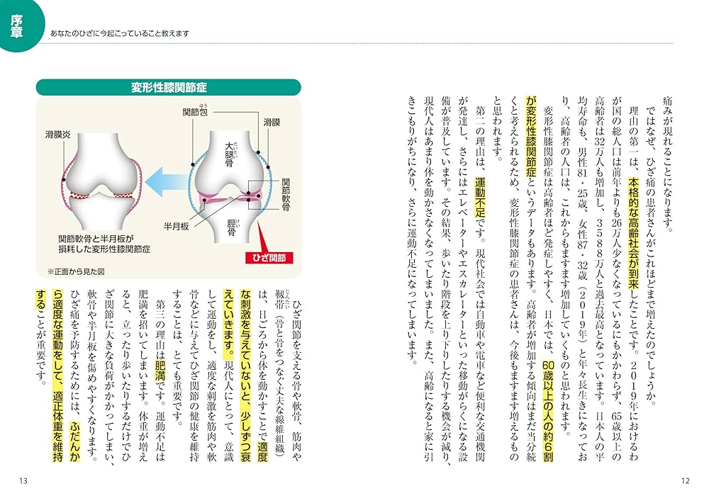 福辻式  DVD  ひざの痛み　1分速攻　寝るだけ　ほったらかし　変形性膝関節症 Amazon.co.jp: ゆっくり伸ばして痛み解消! ひざ痛・変形性膝関節