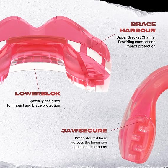 SAFEJAWZ Ice Pink Mouth Guard for Braces, One Size Gum Shield with Case | One Size, Ortho Mouthguard, Easy Fit Remouldable, Boxing, MMA, Rugby, Martial Arts, Hockey, All Contact Sports