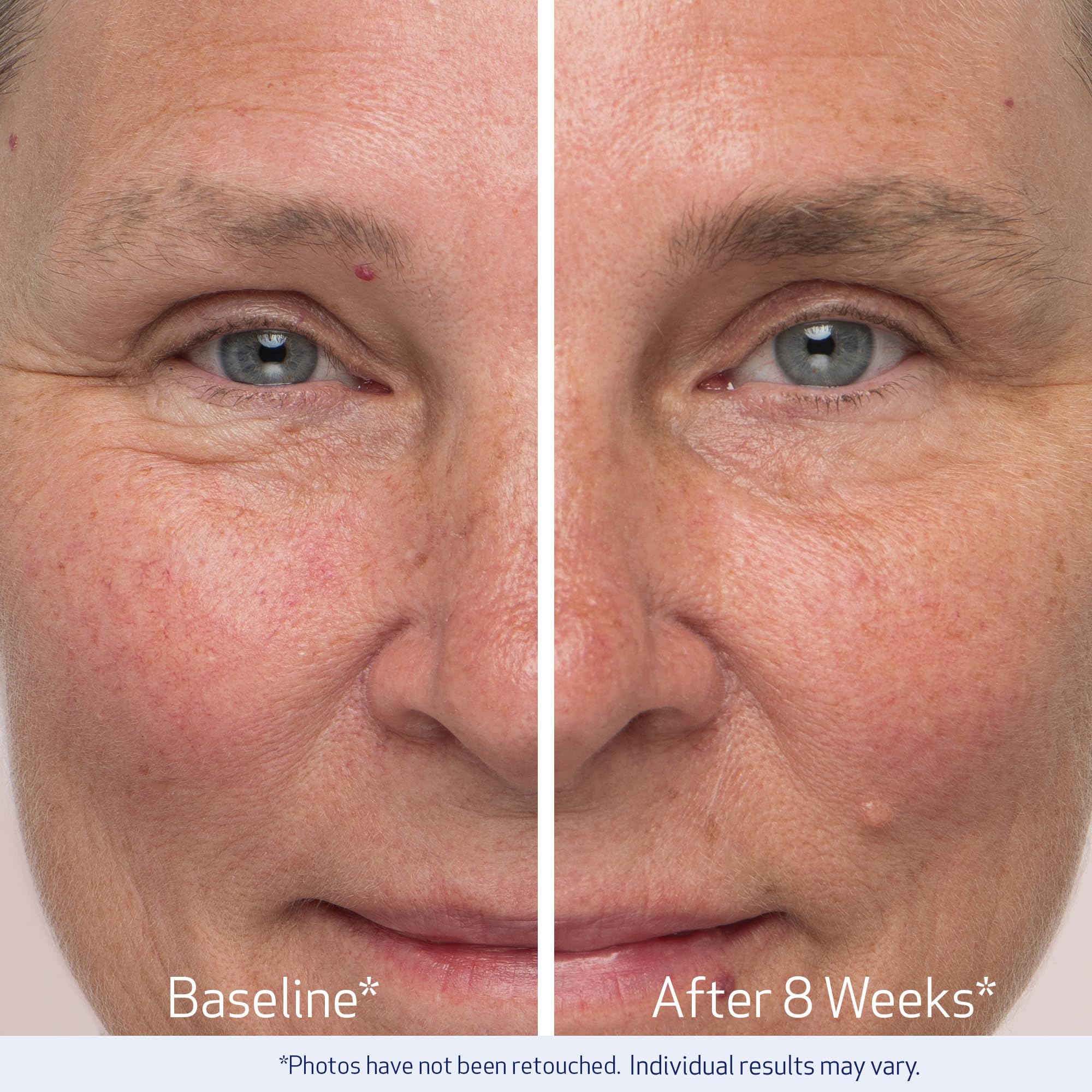 Obagi Nu-Cil Eyebrow Boosting Serum