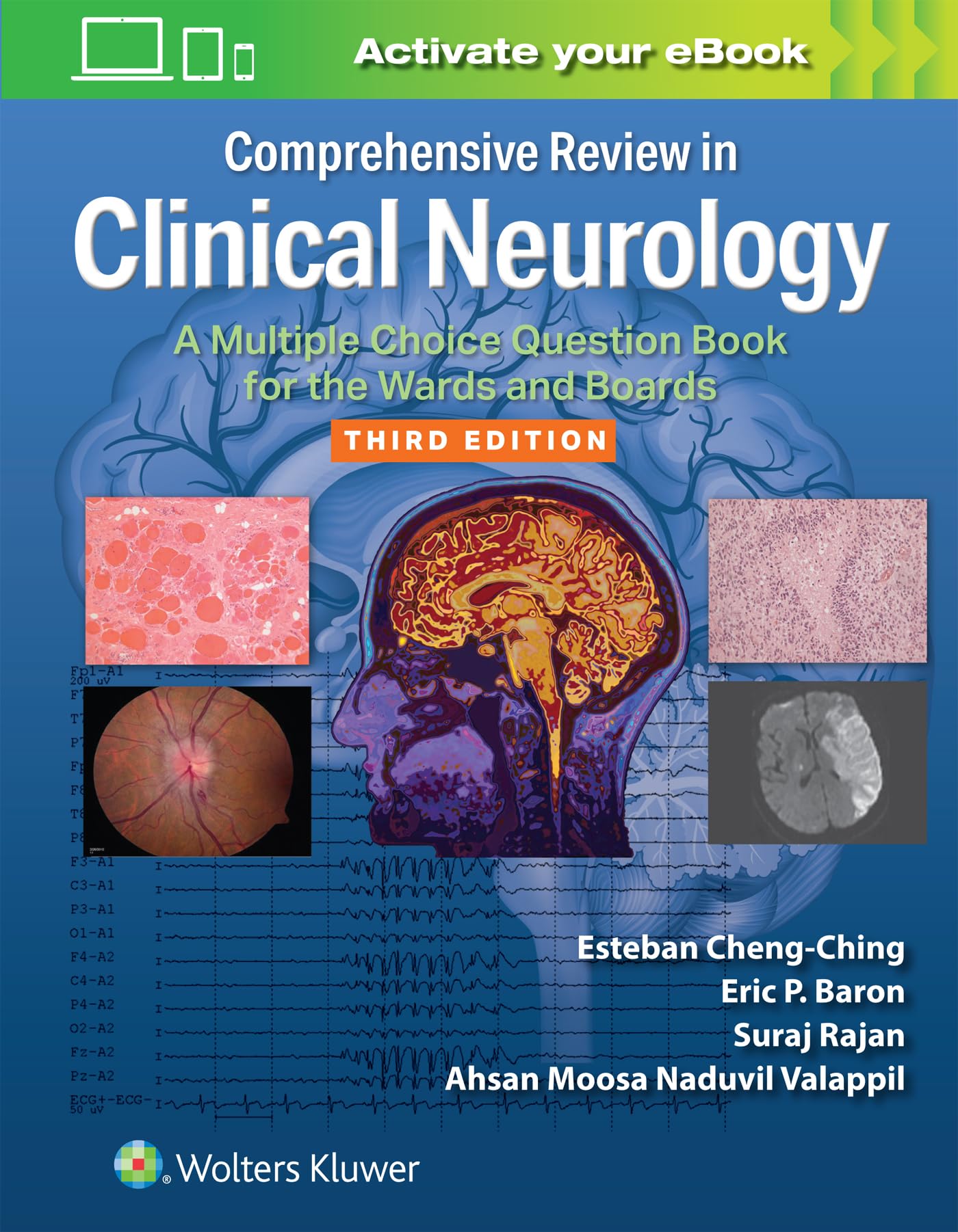 Comprehensive Review in Clinical Neurology: A Multiple Choice Question Book for the Wards and Boards Print + Ebook with Multimedia Third Edition