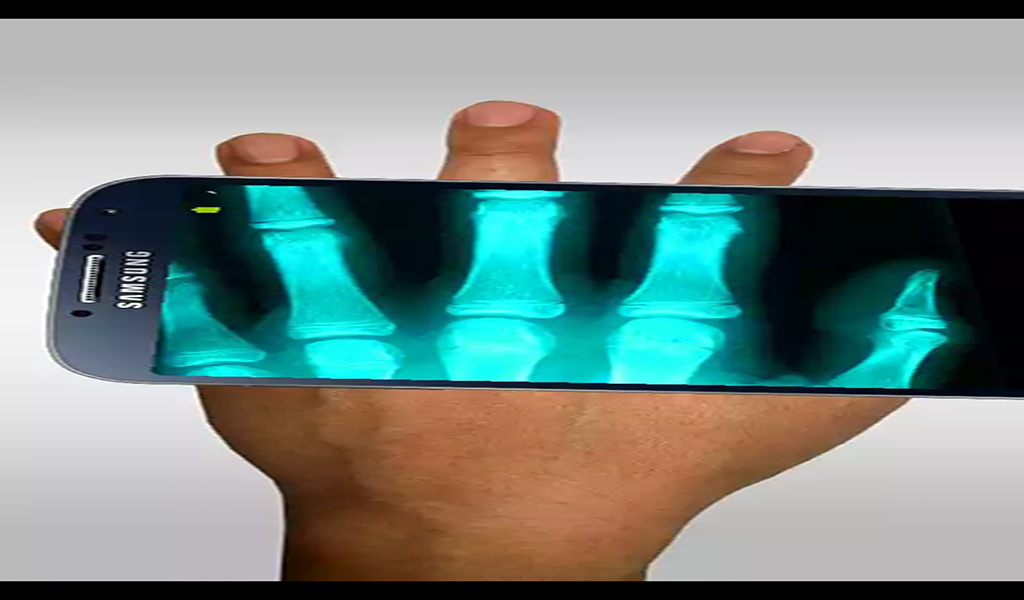 XRay Scanner Camera Pro App on Amazon Appstore