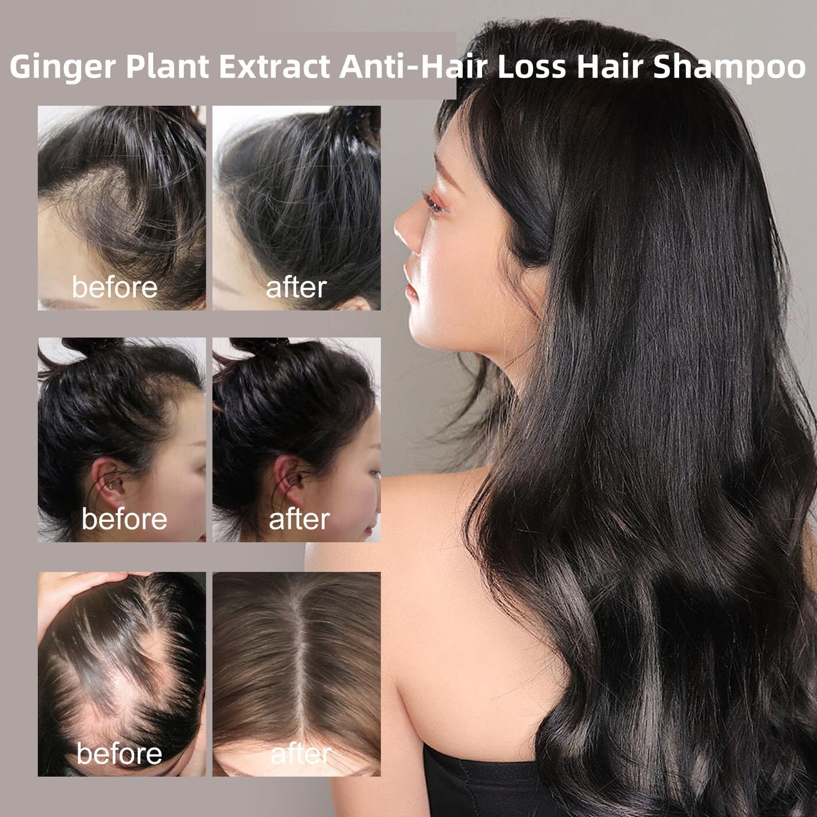 Champú para el cabello anticaída con extracto de planta de jengibre, Polygonum Multiflorum Champú para el cabello con extracto de planta de jengibre anticaída, 240 ml Champú anticaída (3pcs)