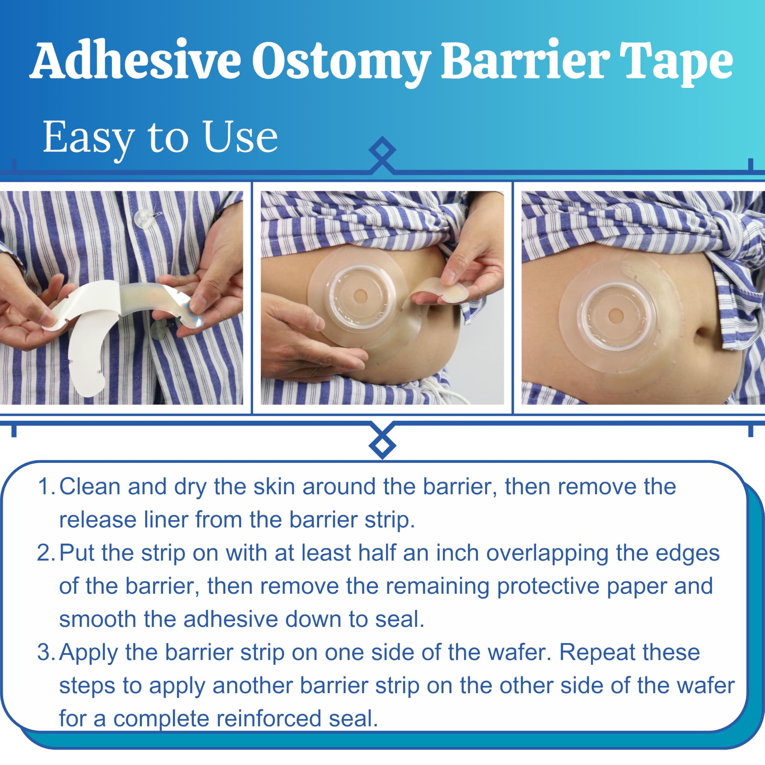 40 tiras de barrera de ostomía con huecos, suministros elásticos de urostomía para ileostomía, cintas extensoras de barrera cutánea para bolsas de colostomía