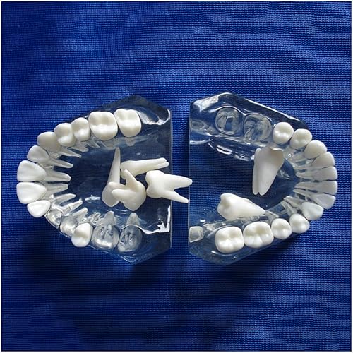 Modelo de enseñanza de estudio de dientes dentales - Modelo de educación dental de ciencias médicas - Modelo de dientes de demostración Ypodont con