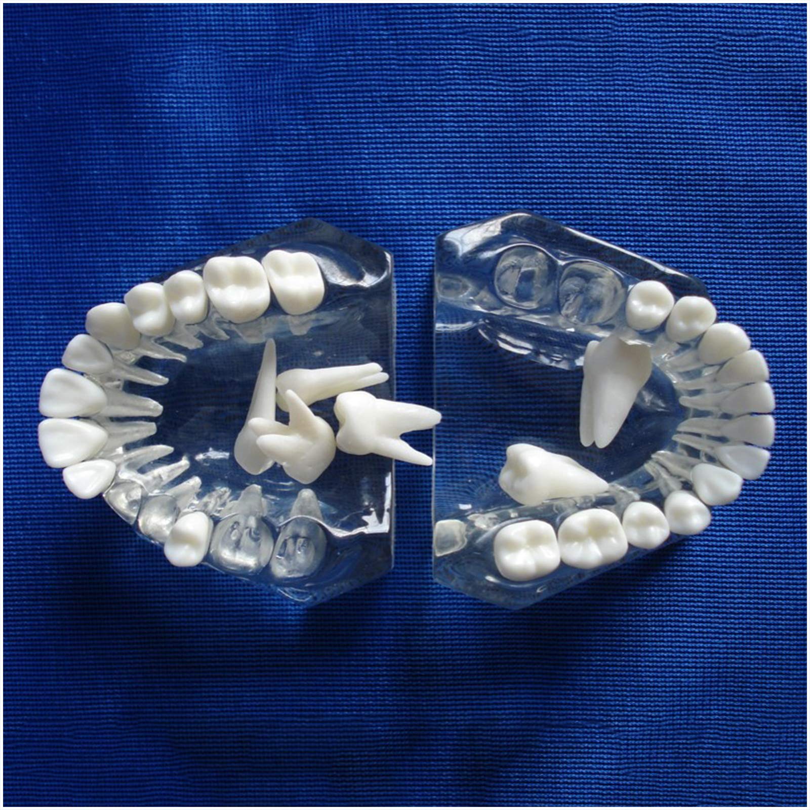Sjdopulse A Dental Teeth Study Teaching Model - Medical Science Dental Education Model - Ypodont Demonstration Teeth Model With Removable Teeth - For Teaching Study (A)