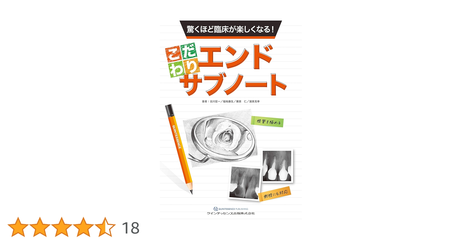 驚くほど臨床が楽しくなる! こだわりエンドサブノート | 吉川