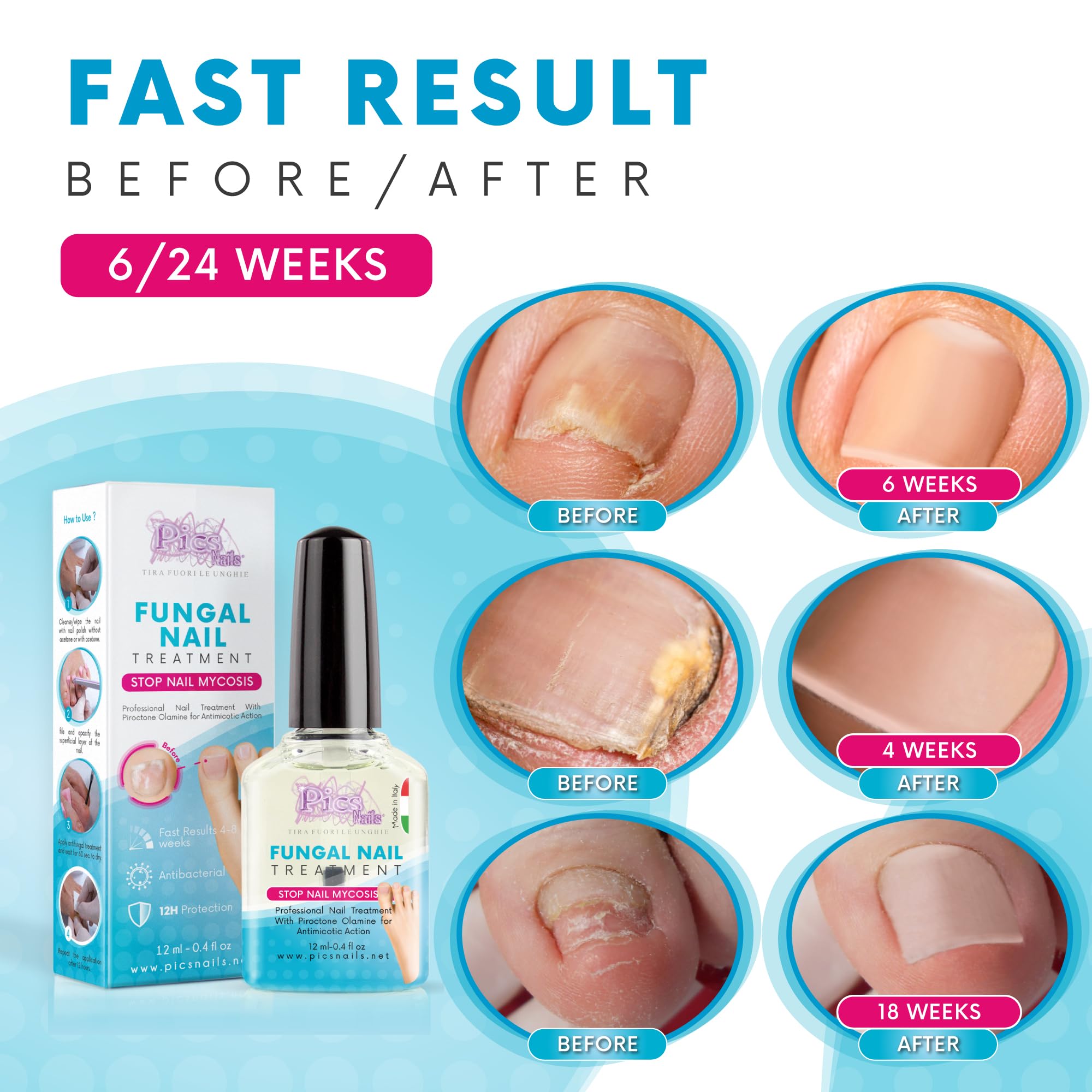 Pics Nails - Środek do Paznokci Stóp i Rąk | 12 ml | Przywraca Naturalny Wygląd Paznokcia | Made in Italy, Biały