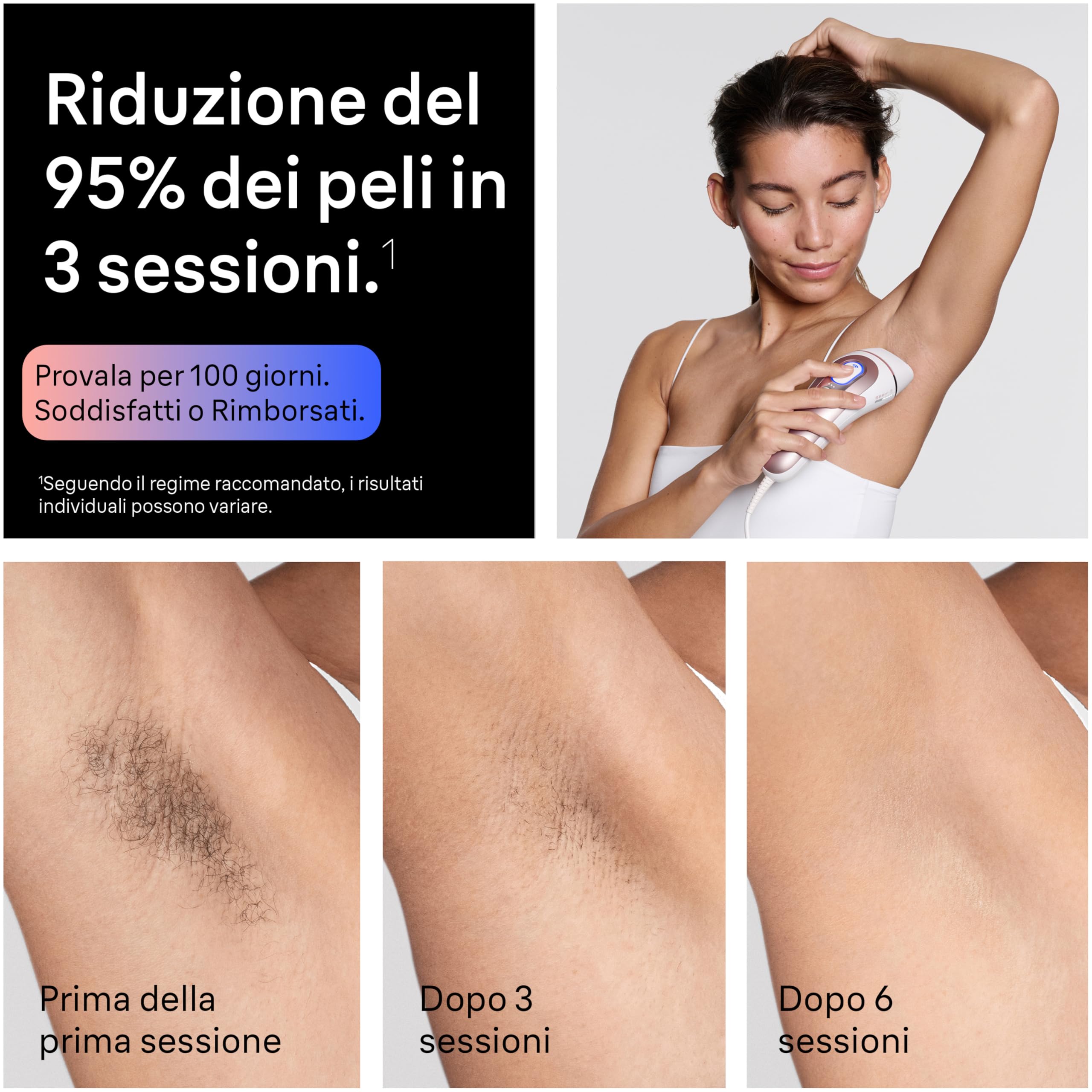 Braun Skin I·Expert Epilatore Luce Pulsata Smart, Epilazione Laser Peli Donna a Casa, Riduzione Permanente Peli, App Gratuita, Pochette, Mini Depilatore Viso, Rasoio Gillette Venus, 4 Testine, Pl7432