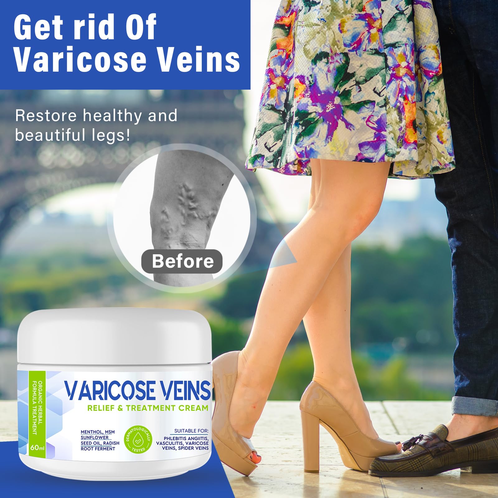 Varicose Veins Treatment for Legs, Varicose Veins Relief Cream, Improve Leg Appearance, Boost Blood Circulation - Image 2