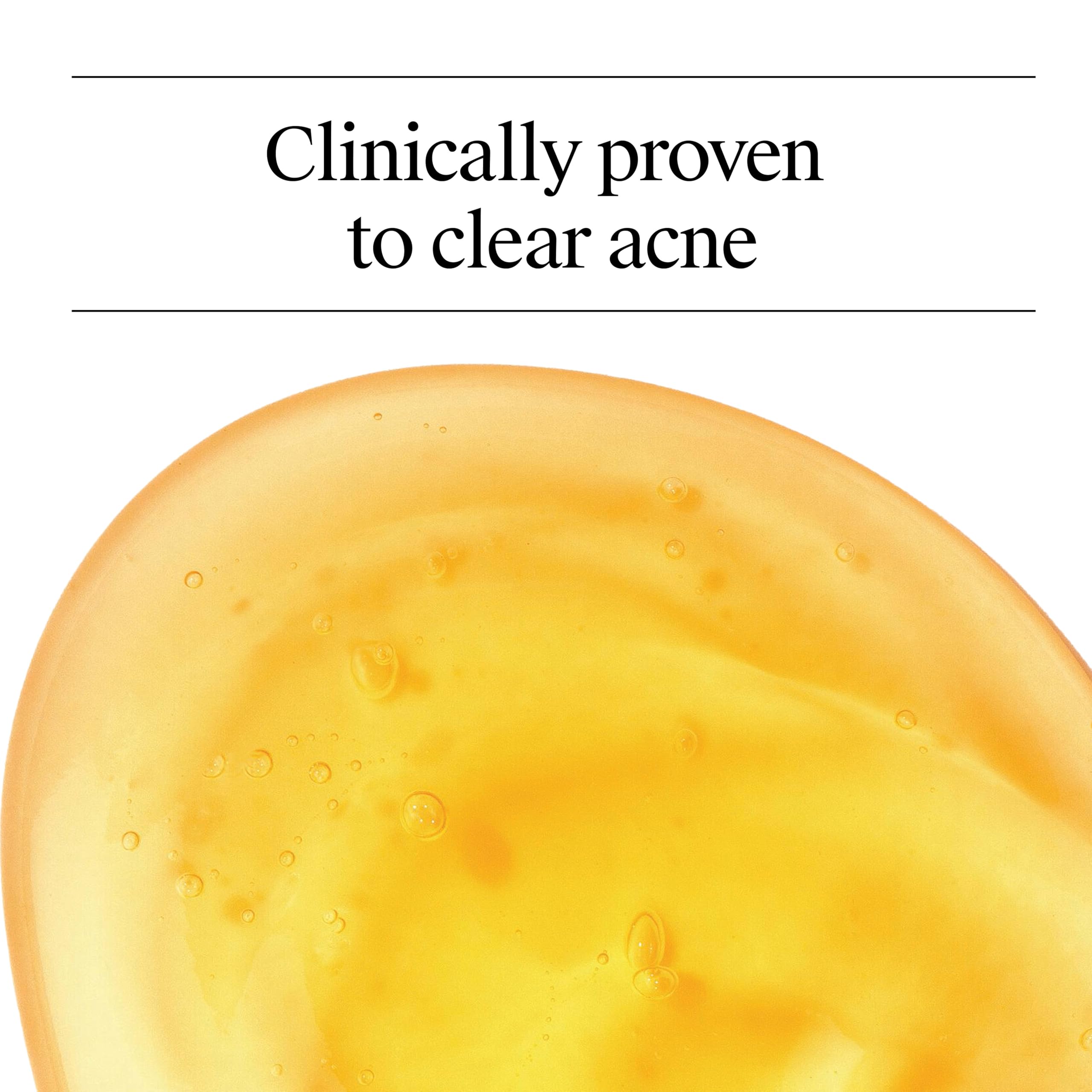 Neutrogena Oil Free Acne Face Wash with 2% Salicylic Acid, 9.1 Fl Oz, 3 Pack