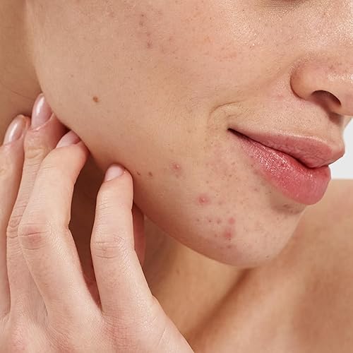 Miniatura 4 de PAI SKINCARE - Potenciador aclarante de ácido salicílico natural  Cuidado de la piel natural, vegano y sensible (0.3 fl oz  0.3 fl oz)