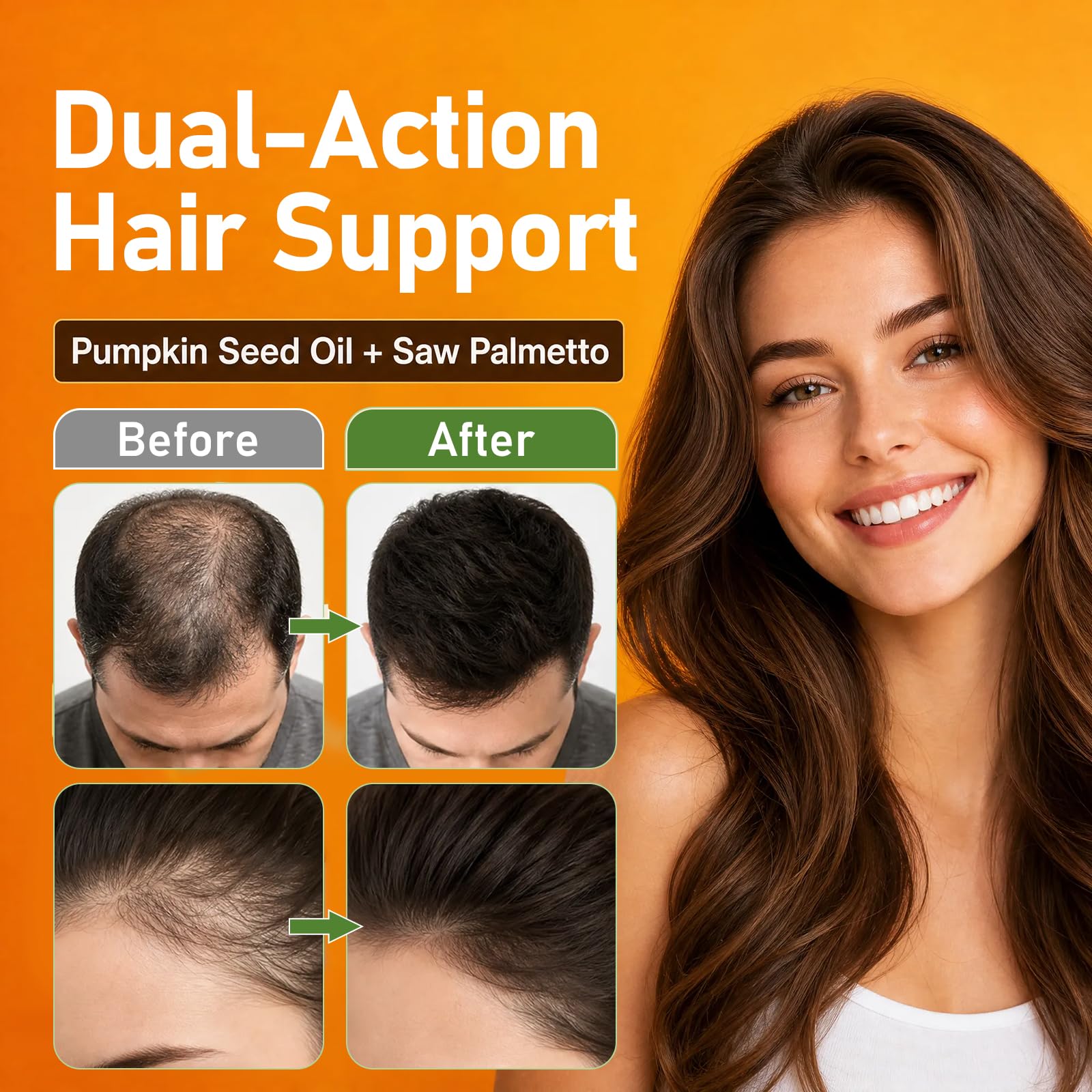 Pumpkin Seed Oil Capsules - Saw Palmetto Pumpkin Seed Oil 300 Softgels 3000mg for Prostate Health, Immune and Urinary Tract Support Promotes Hair Growth - Pure Non GMO — Amazon image 5