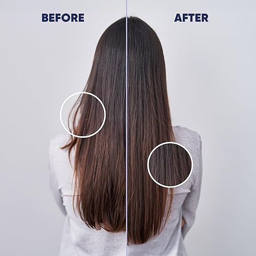 Miniatura 3 de MOERIE Ultimate - Suero para el crecimiento del cabello para el crecimiento natural del cabello y el engrosamiento, tratamiento antiadelgazamiento y