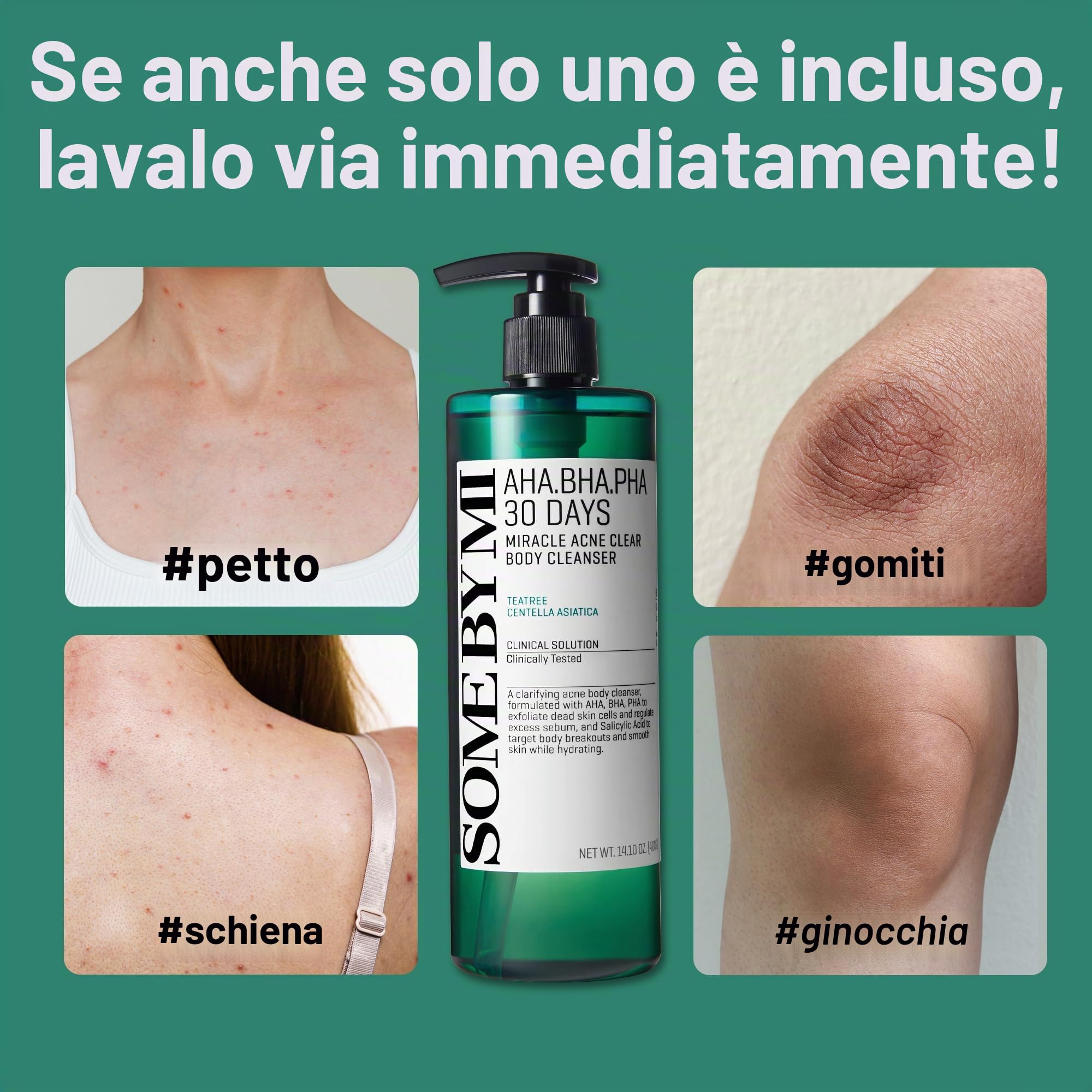 SOME BY MI AHA BHA PHA 30 Days Miracle Acne Clear Body Cleanser – 400ml – Detergente corpo quotidiano coreano con tea tree – Purifica il sebo e le impurità – Cura coreana