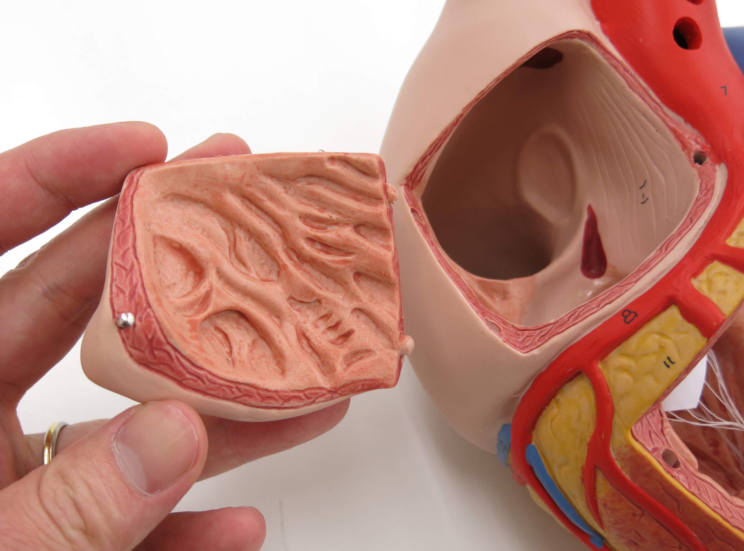 3B Scientific G06 Modello di Anatomia Umana Cuore con Bypass, Ingrandito 2 Volte, in 4 Parti + software gratuito di anatomia - 3B Smart Anatomy
