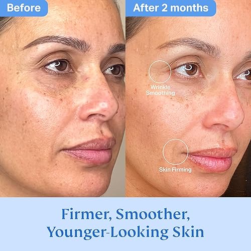 Miniatura 4 de HYDRONOVA by Dr. Vonda Total Rewind Sculpting Serum  1 onza líquida  Corrector de manchas oscuras  Vitamina C, niacinamida, ácido kójico, péptidos