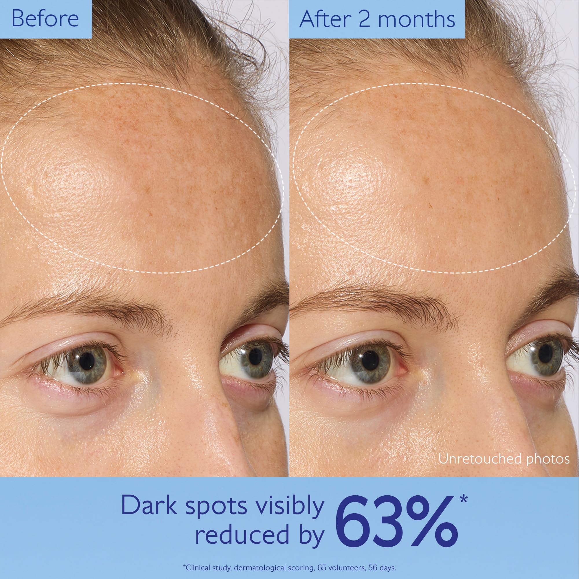 Caudalie Vinoperfect Serum für mehr Ausstrahlung und gegen Pigmentflecken