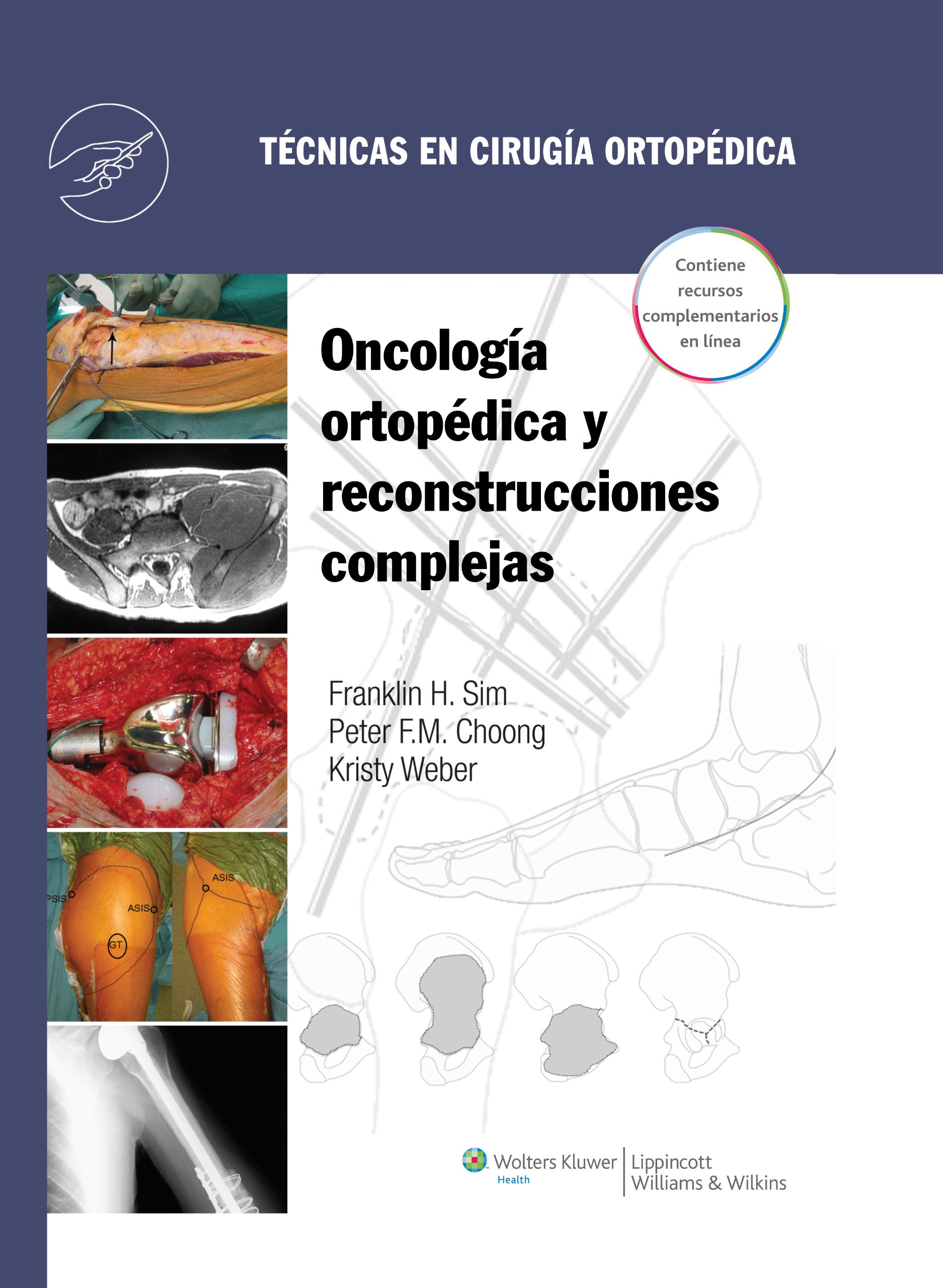 Técnicas en cirugía ortopédica. Oncología ortopédica y reconstrucciones complejas (Spanish Edition)