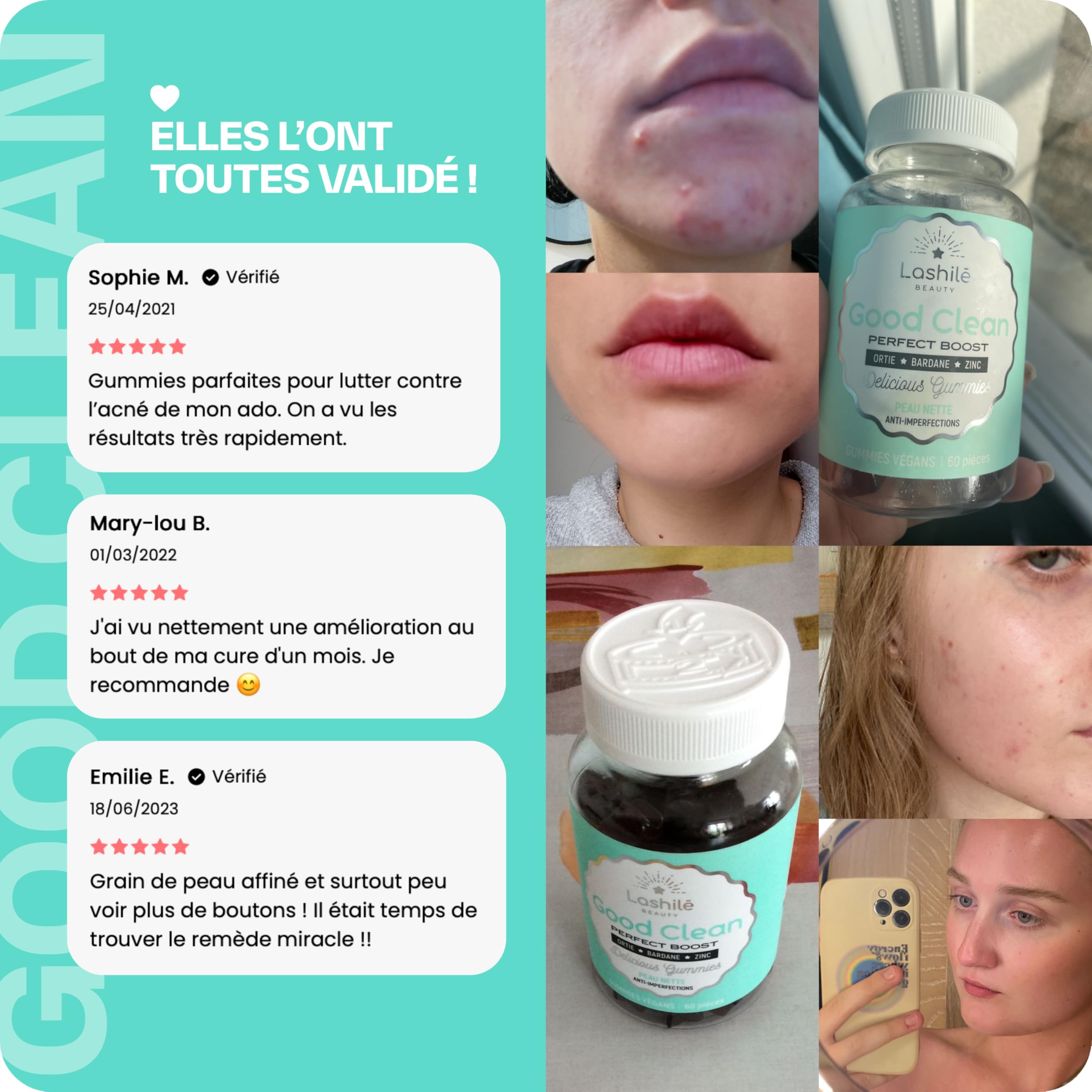 Lashilé Beauty - Gummies Peau - Peau Nette & Anti-Imperfections - Régule le Sébum & Purifie - Good Clean Vitamines - Complément Alimentaire Anti-Acné -Bardane Ortie Zinc - Cure 1 Mois 60 Gummies
