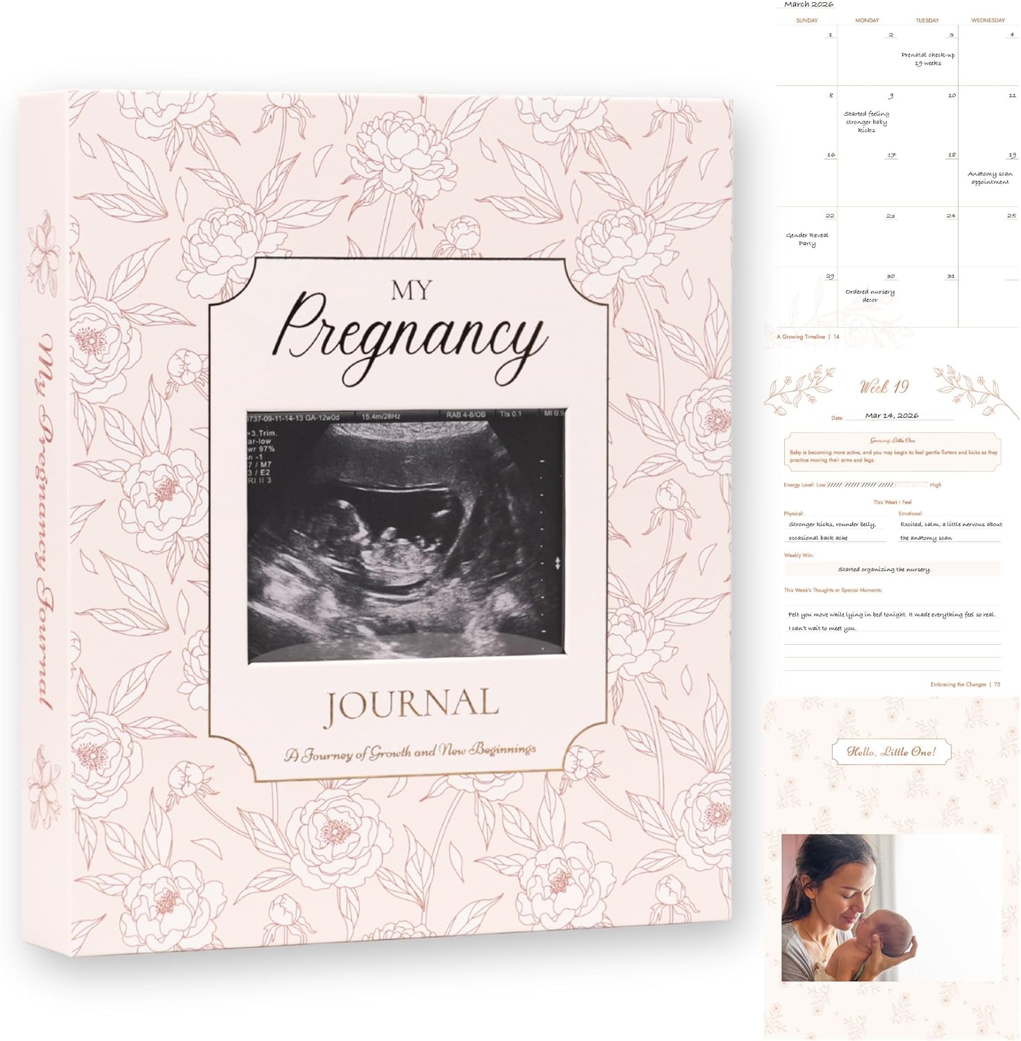 Pregnancy Journal for First Time Moms – Baby Journal Memory Book Keepsake, Pregnancy Planner & Photo Album with Trimester Tracker – Thoughtful Gift for Expecting Mothers (Photo Insert)