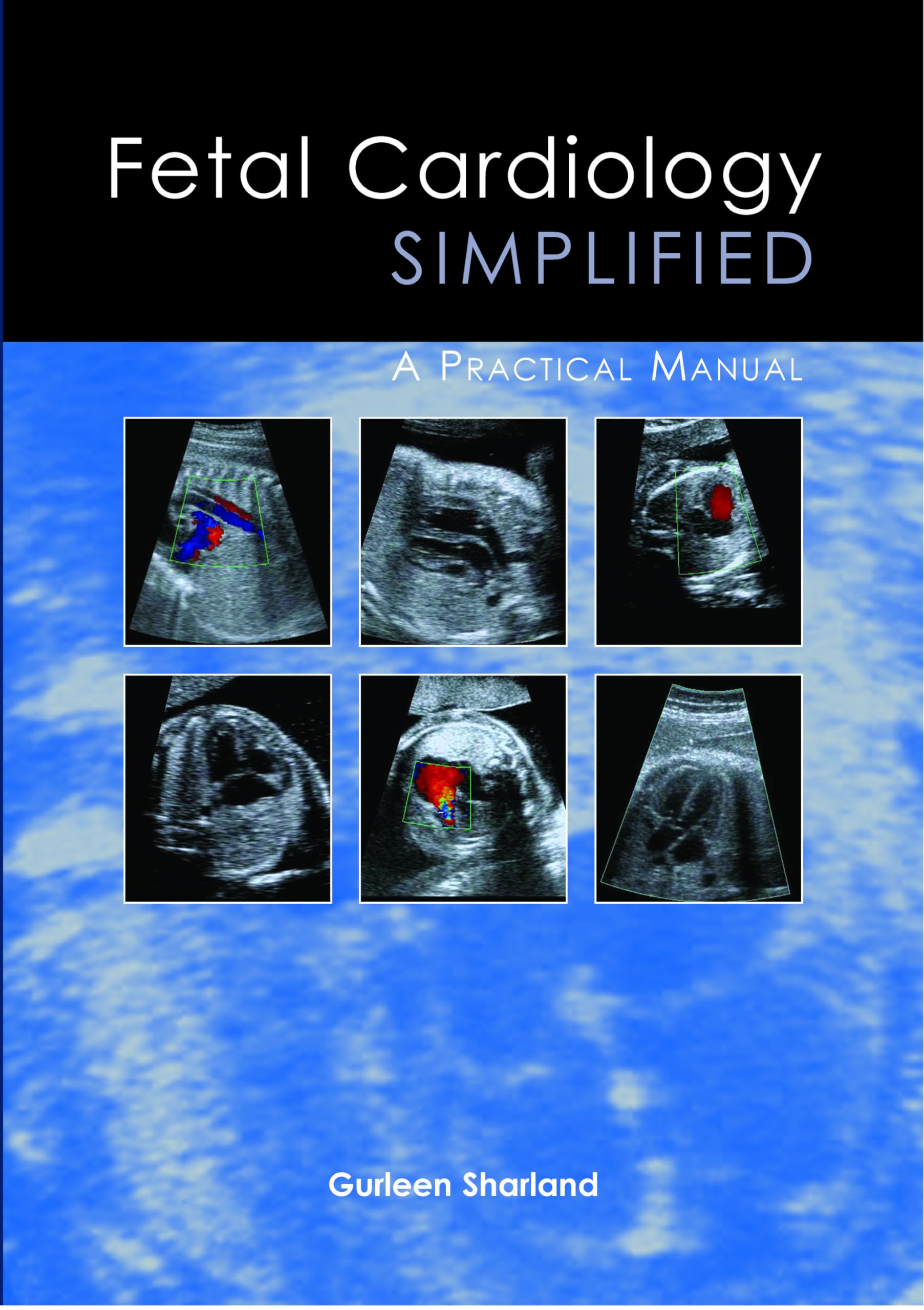 Fetal Cardiology Simplified: A Practical Manual by Gurleen Sharland...