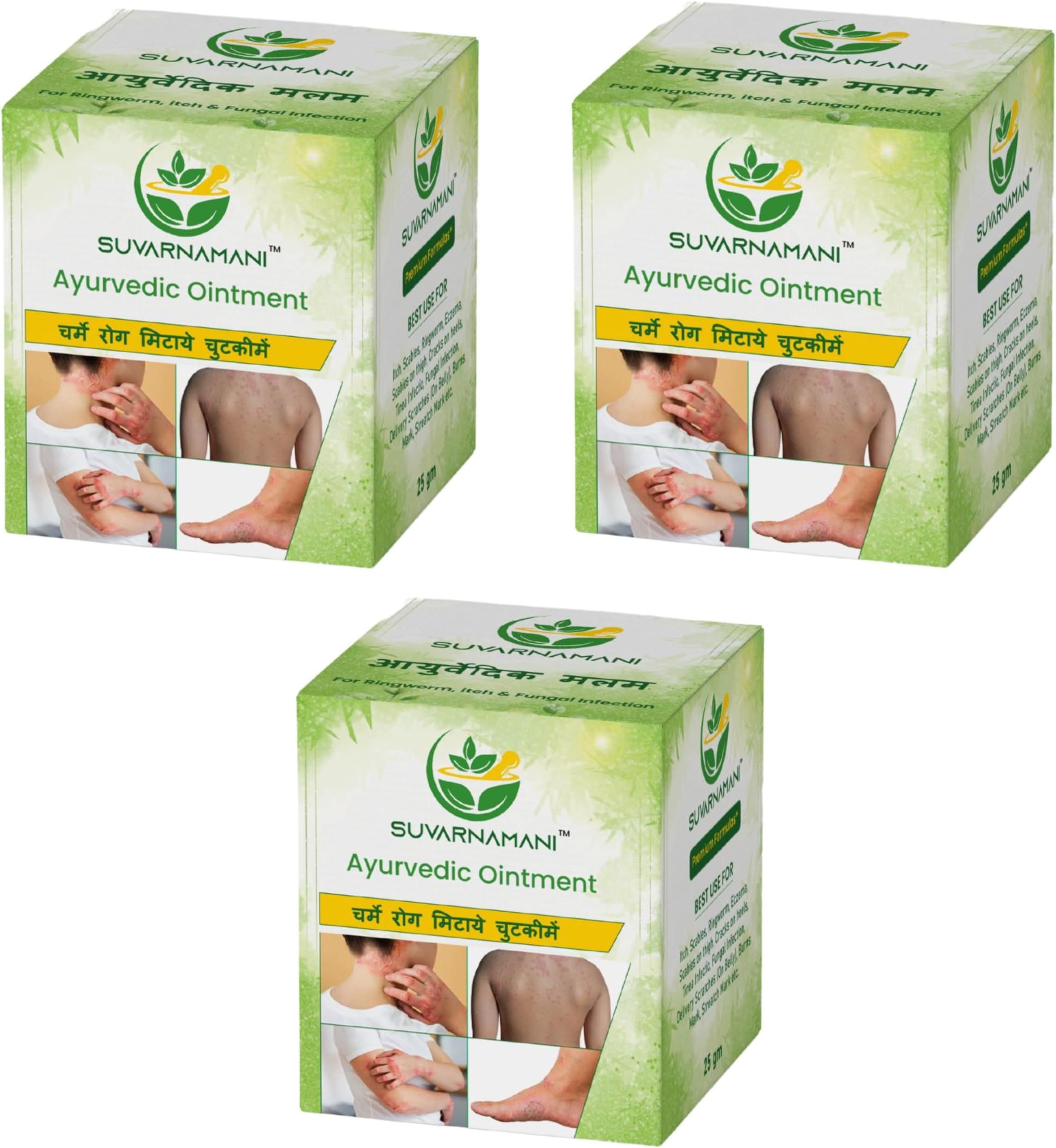 Ayurvedic Ointment Malam for Ringworm, Itching Cream and Fungal Infections